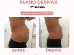 Foto de Dermax estética e saúde em Lauro de Freitas, BA por Solutudo