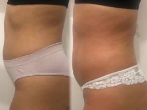 Foto de Dermax estética e saúde em Lauro de Freitas, BA por Solutudo