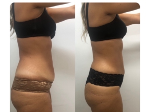 Foto de Dermax estética e saúde em Lauro de Freitas, BA por Solutudo