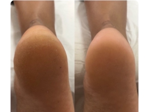 Foto de Dermax estética e saúde em Lauro de Freitas, BA por Solutudo