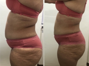 Foto de Dermax estética e saúde em Lauro de Freitas, BA por Solutudo