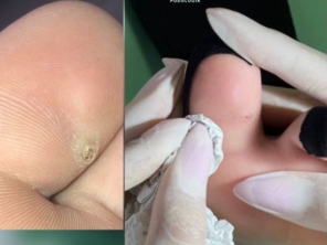 Foto de Luara Carneiro podologia e saúde em Indaiatuba, SP por Solutudo