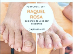 Foto de Raquel - Podologia em Botucatu, SP por Solutudo