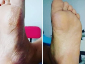 Foto de Raquel - Podologia em Botucatu, SP por Solutudo
