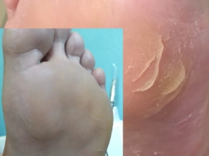 Foto de Raquel - Podologia em Botucatu, SP por Solutudo