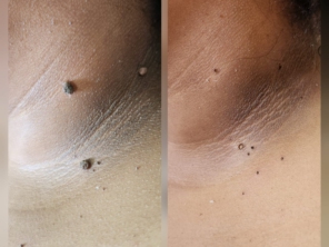 Foto de Belas Amoras Esteticista em Frutal, MG por Solutudo