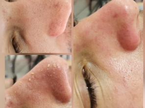 Foto de Belas Amoras Esteticista em Frutal, MG por Solutudo