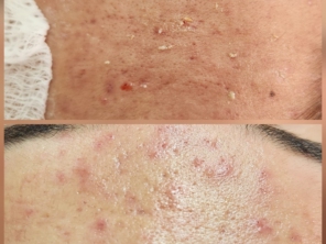 Foto de Belas Amoras Esteticista em Frutal, MG por Solutudo