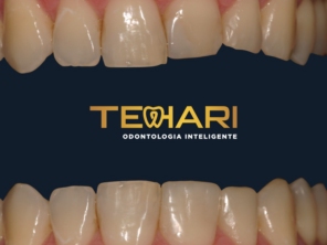 Foto de Tehari Odontologia Inteligente em Osasco, SP por Solutudo