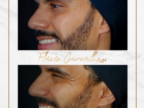 Foto de Flávio Carvalho - Estética Avançada em Brasília, DF por Solutudo