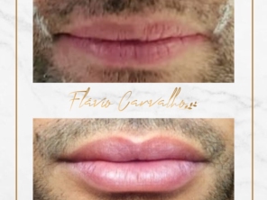Foto de Flávio Carvalho - Estética Avançada em Brasília, DF por Solutudo
