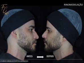 Foto de Flávio Carvalho - Estética Avançada em Brasília, DF por Solutudo