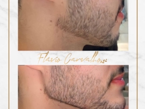 Foto de Flávio Carvalho - Estética Avançada em Brasília, DF por Solutudo