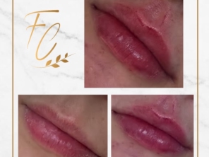 Foto de Flávio Carvalho - Estética Avançada em Brasília, DF por Solutudo