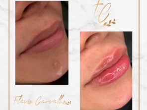 Foto de Flávio Carvalho - Estética Avançada em Brasília, DF por Solutudo