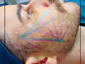 Foto de Flávio Carvalho - Estética Avançada em Brasília, DF por Solutudo