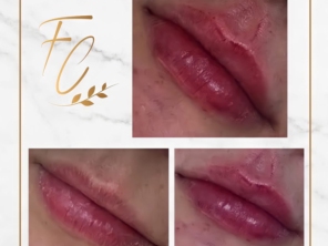 Foto de Flávio Carvalho - Estética Avançada em Brasília, DF por Solutudo