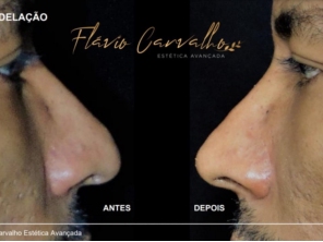 Foto de Flávio Carvalho - Estética Avançada em Brasília, DF por Solutudo