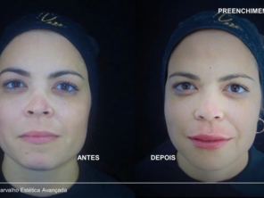 Foto de Flávio Carvalho - Estética Avançada em Brasília, DF por Solutudo