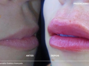 Foto de Flávio Carvalho - Estética Avançada em Brasília, DF por Solutudo