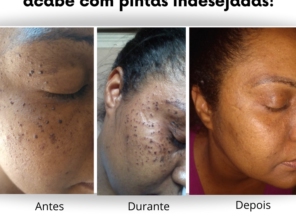 Foto de Silvana Almeida estética em Belo Horizonte, MG por Solutudo