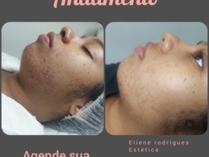 Foto de Eliene Rodrigues Estética em Armação dos Búzios, RJ por Solutudo