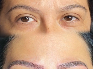 Foto de Márcia Guimarães Estética e Micropigmentação em Goiatuba, GO por Solutudo