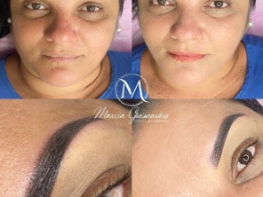 Foto de Márcia Guimarães Estética e Micropigmentação em Goiatuba, GO por Solutudo