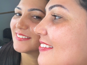 Foto de Márcia Guimarães Estética e Micropigmentação em Goiatuba, GO por Solutudo