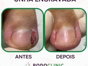 Foto de PodoClinic Clínica de Podologia em Itaitinga, CE por Solutudo