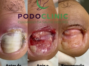 Foto de PodoClinic Clínica de Podologia em Itaitinga, CE por Solutudo