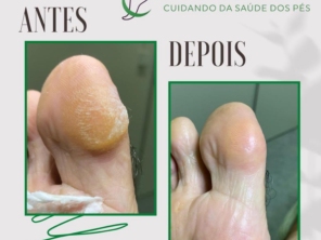 Foto de PodoClinic Clínica de Podologia em Itaitinga, CE por Solutudo