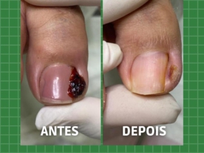 Foto de PodoClinic Clínica de Podologia em Itaitinga, CE por Solutudo