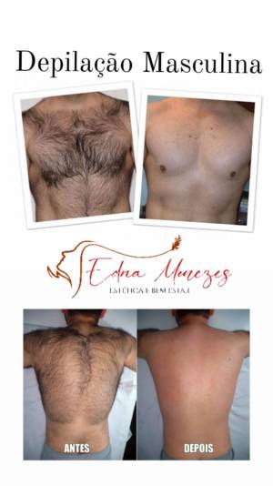 D ( Epilação ) Masculina 