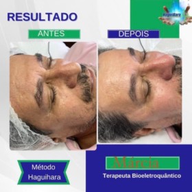 Mappelle Estética