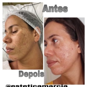 Mappelle Estética