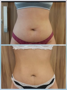 Mariana Venite | Estetica