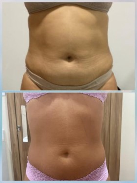 Mariana Venite | Estetica