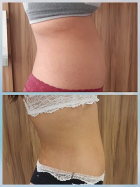 Mariana Venite | Estetica