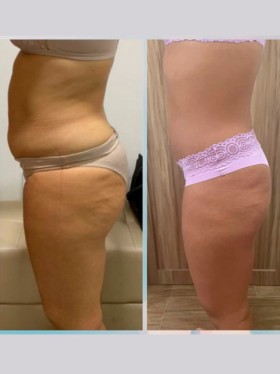 Mariana Venite | Estetica