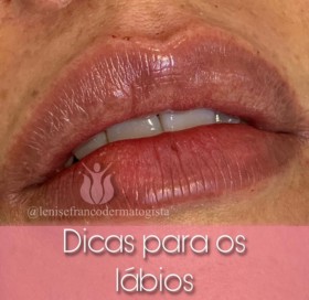 SEUS LÁBIOS ESTÃO RESSECADOS?   A primeira coisa que fazemos quando isso acontece INSTINTIVAMENTE é lamber os lábios, na esperança de aliviar a sensação de ressecamento, não é verdade?   Mas, ATENÇÃO! Saiba que a saliva irrita e resseca ainda mais os lábi
