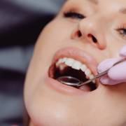 Odontologia Estética Em São José Dos Campos: Como Valorizar Seu Sorriso Com Segurança