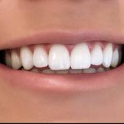 Karen Castillo Em São José Dos Campos: Cuidado Com Seu Sorriso Todos Os Dias