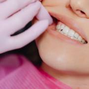 Sorriso Saudável em Sarandi PR: Como a Odontologia Cardoso Faz a Diferença
