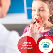 Quando retirar as amígdalas
