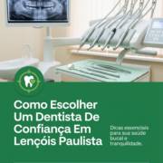 Como Escolher Um Dentista De Confiança Em Lençóis Paulista