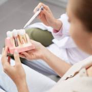 A importância do implante dentário para a sua saúde e autoestima!