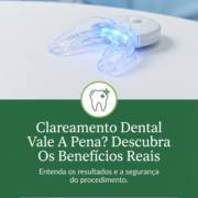 Clareamento Dental Vale A Pena? Descubra Os Benefícios Reais