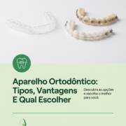 Aparelho Ortodôntico: Tipos, Vantagens E Qual Escolher