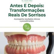 Antes E Depois: Transformações Reais De Sorrisos